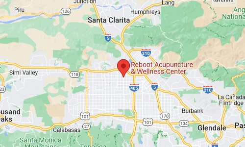 Acupuncturists in California, Granada Hills CA 91344