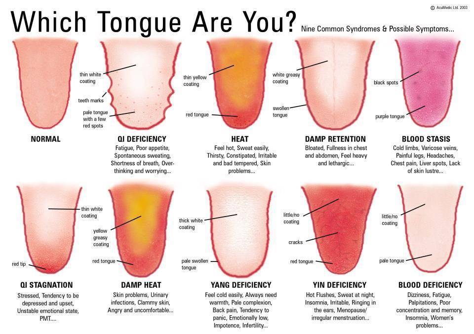 How Do Our Tongues Reveal Our Health on Acupuncture Near Me Photo 2